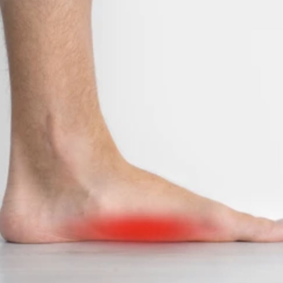 Flat Feet & Arch Problems