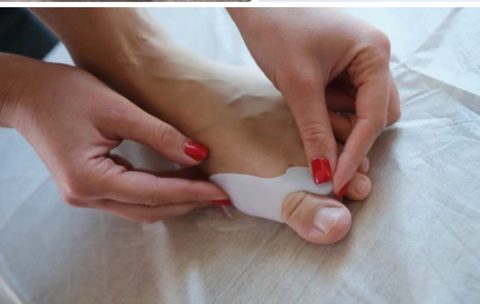 Bunion Treatment Without Surgery: What Actually Works